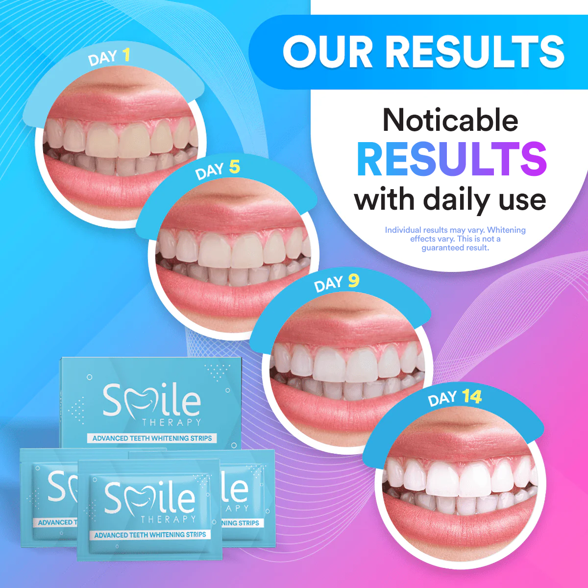 Teeth Cleaning & Whitening Strips (14 Treatments)