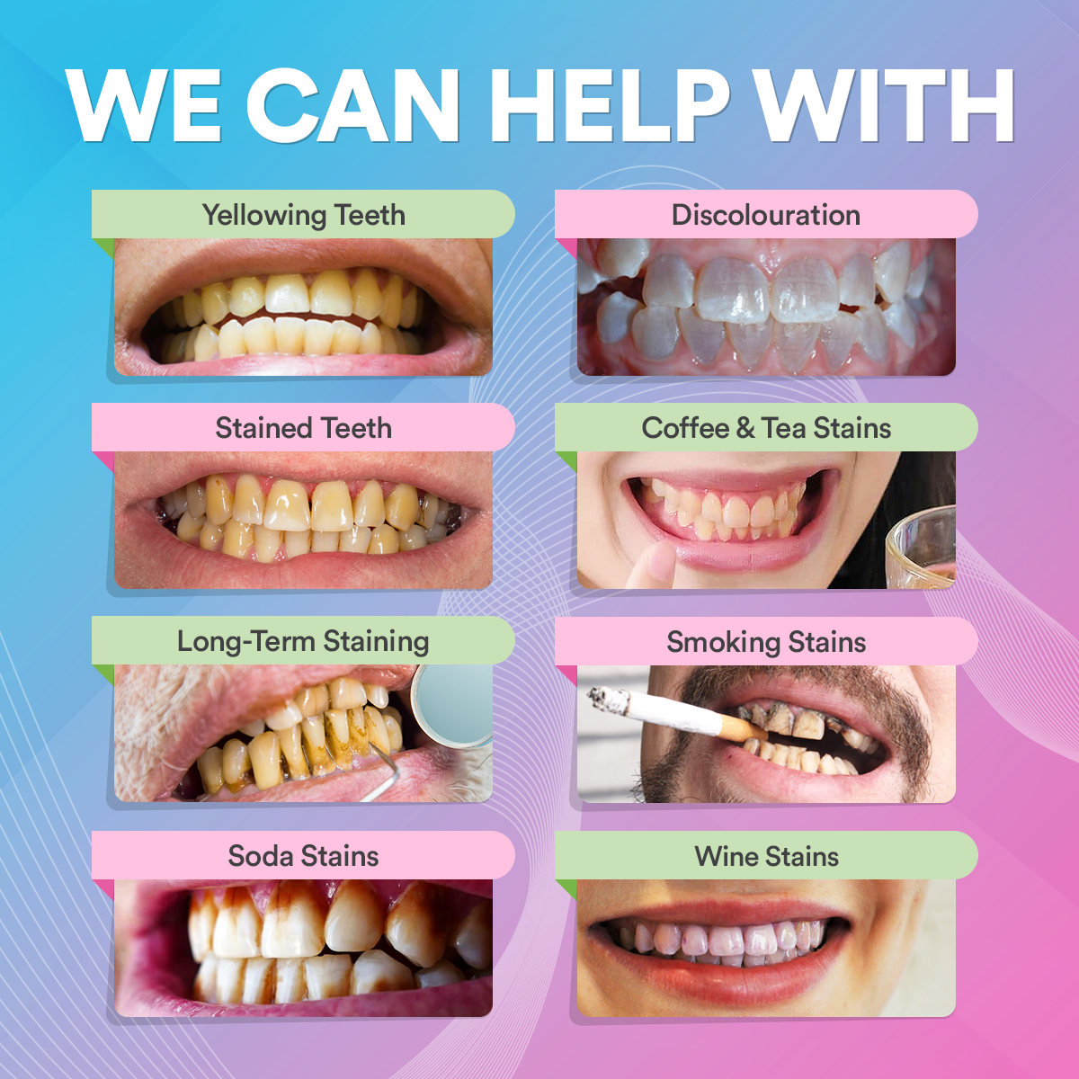 Teeth Whitening Pen DP6