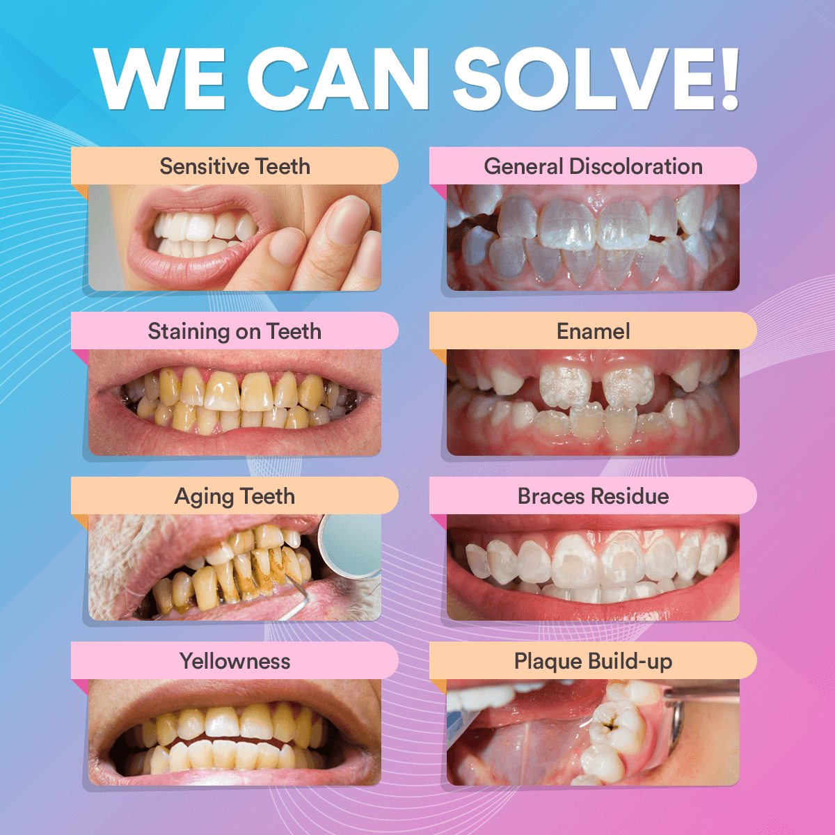 Advanced Teeth Whitening Kit PAP+ DP5