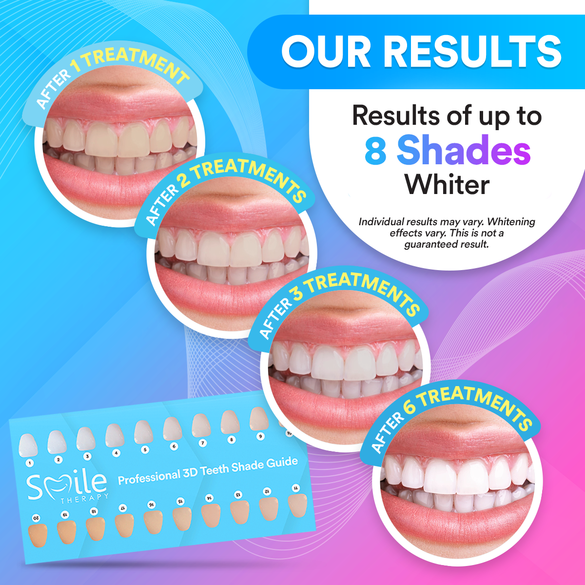 Advanced Teeth Whitening Kit PAP+ DP12