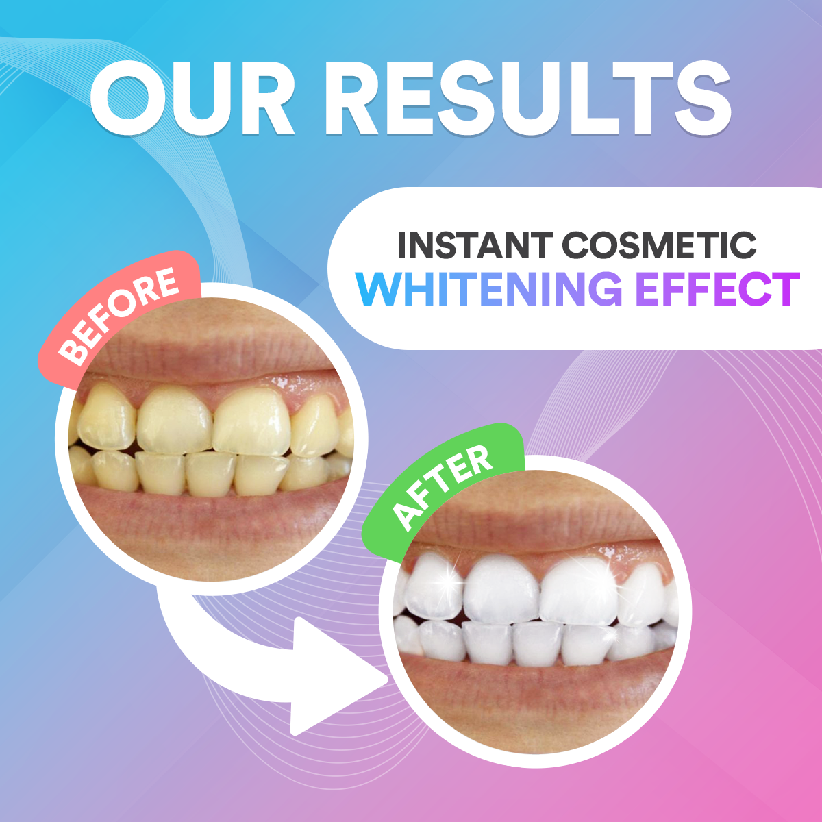 Teeth Whitening Pen TT1
